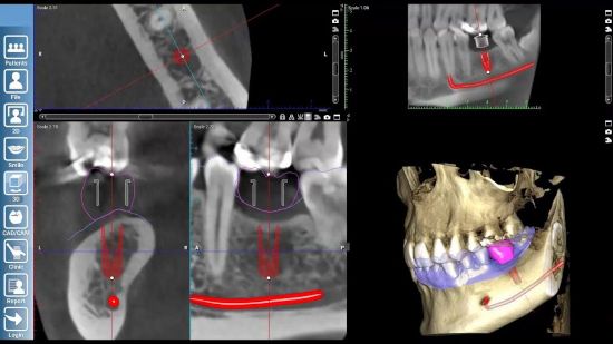 3D Dental X-ray