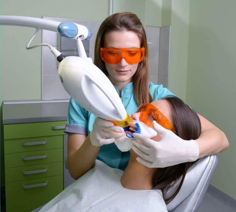 In-Office Teeth Whitening Procedure