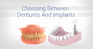 Image showing dentures vs dental implants