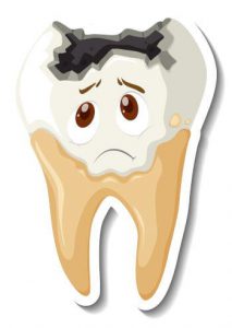 Tooth Decay Illustration