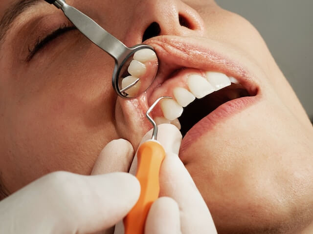 Dentist Examining a Patient for gum disease