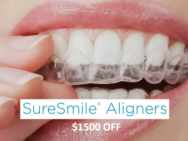 Discount on Clear Aligners